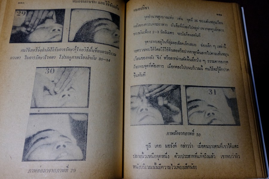 หมอจีนฝังเข็ม เเละ วิธีจับเส้นชีพจร กับ การนวด โดย หมอปรีชา ปกเเข็ง 336 หน้า ปี 2536