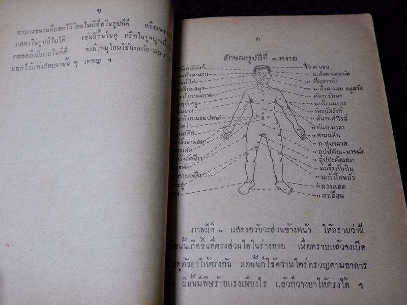 ตำราโบราณ ยาเเก้ฝีร้ายต่างๆ ยาเเก้ลมมีพิษ ยาเเก้โรคต่างๆ รวม 335 ขนาน โดย ส.ศ. ปี 2493( Pre-Order สอบถาม)