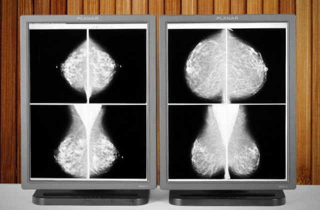 จอสำหรับการแพทย์ ความละเอียดสูง 21.3 Monochrome greyscale Lcd