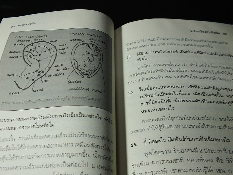 การเเพทย์จีน โดย ศ.นายเเพทย์ หลี่ กั๊วะ โต้ง หนา 173 หน้า