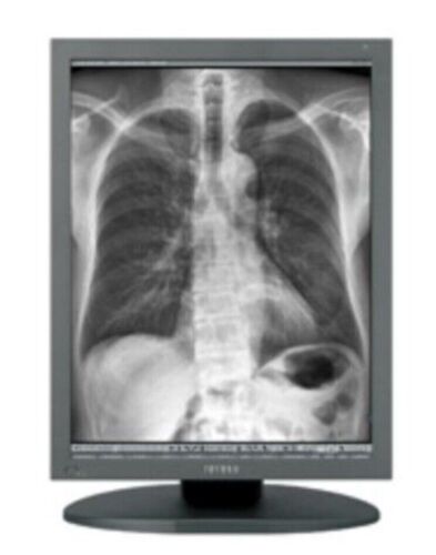 จอ LCD ยี่ห้อTotoku รุ่น MS33i2 (ML21033)20.8 นิ้ว สำหรับการแพทย์ /อุตสาหกรรมความละเอียดสูง