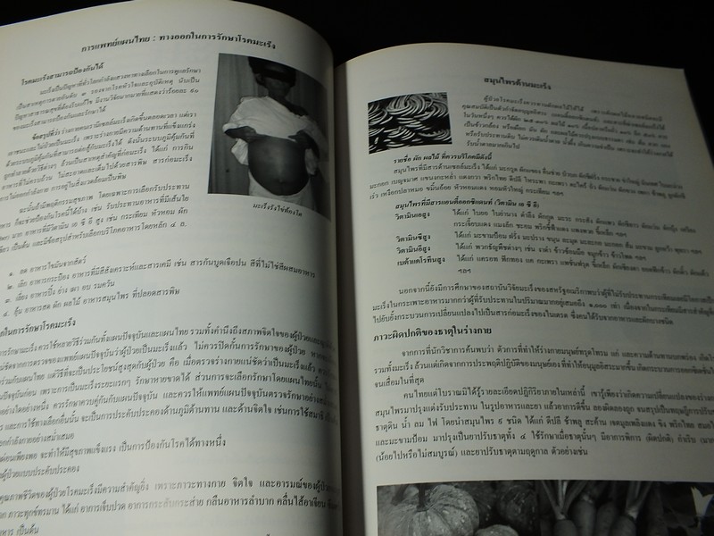 นิทรรศการชุุมนุมเเพทย์เเผนไทยเเละสมุนไพรเเห่งชาติ ครั้งที่ 2 โดยสถาบันการเเพทย์ไทย หนา 112 หน้า ปี 2540