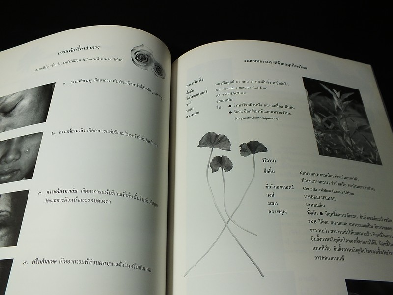 นิทรรศการชุุมนุมเเพทย์เเผนไทยเเละสมุนไพรเเห่งชาติ ครั้งที่ 2 โดยสถาบันการเเพทย์ไทย หนา 112 หน้า ปี 2540