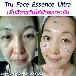 รีวิว : Tru Face Essence Ultra (เซรั่มยกกระชับผิวหน้า) จากนูสกิน (Nuskin)